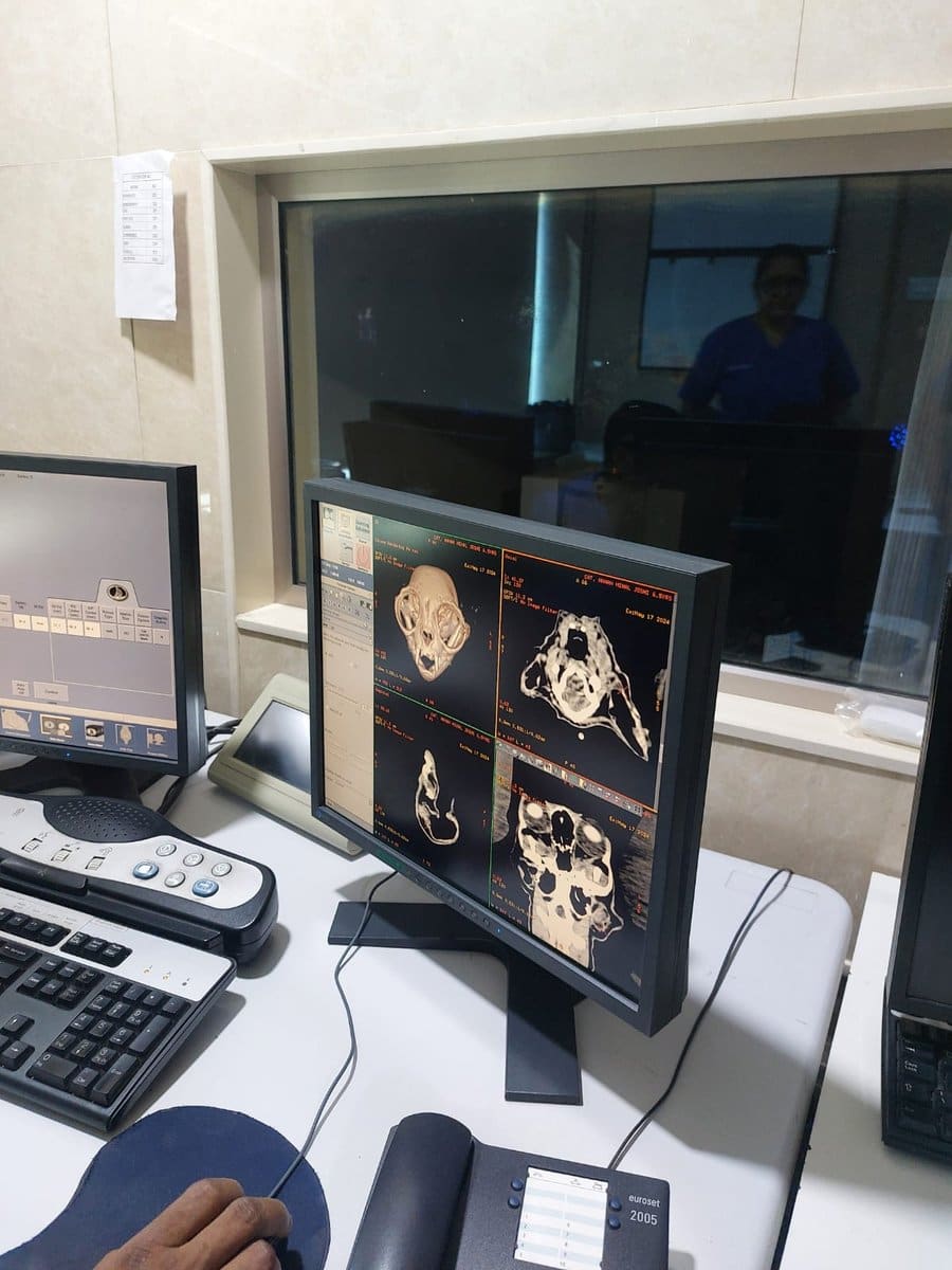 CT imaging workstation displaying a scan